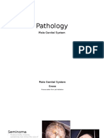 Pathology Male Genital System (Gross and Histology)