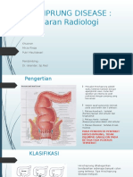 Hirchprung Disease