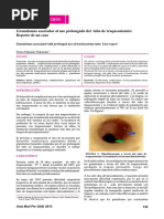 Granulomas Asociados Al Uso Prolongado Del Tubo de Traqueostomia