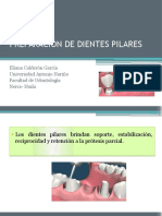 Preparación de Dientes Pilares