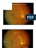 Identify Vein, Artery, Disc, Optic Cup, Fovea