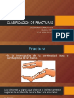 Clasificacion de Fracturass