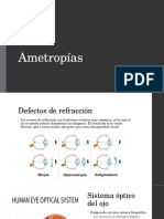 Ametropías