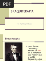 Braquiterapia