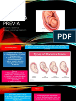 Placenta Previa