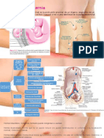 Hernias