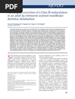 Nonsurgical Correction of A Class III Malocclusion in An Adult by Miniscrew-Assisted Mandibular Dentition Distalization