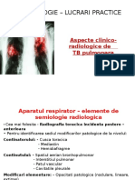 Aspecte Clinico-Radiologice de TB Pulmonara - Scurtat