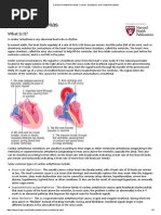 Cardiac Arrhythmias Guide - Causes, Symptoms and Treatment Options