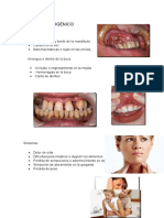 Periodo Patogénico Cancer Oral