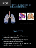 TC Torax Pediatria