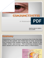 Conjungtivitis