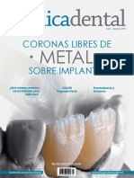 Coronas Libres de Metal Sobre Implantes