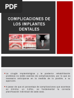 Complicaciones de Los Implantes Dentales