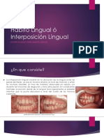 Habito Lingual Ó Interposición Lingual