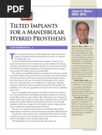 Tilted Implants For A Mandibular Hybrid Prosthesis: James A. Rivers, DMD, Mhs