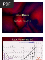 ECG ECG Basics Presentation 201309101527422446 PDF