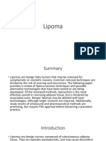 Lipoma