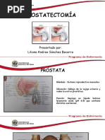 Prostatectomía