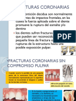 Fracturas Coronarias