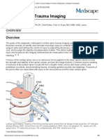 Lumbar Spine Trauma Imaging - Overview, Radiography, Computed Tomography