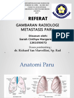 Sarah Cinthya 1261050072 - Gambaran Radiologi Metastasis Paru