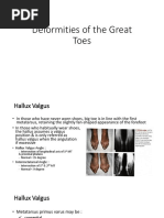 Deformities of Greater and Lesser Toes