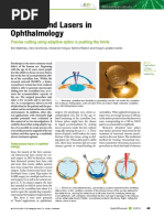 Ophthalmology Femtosecond Laser