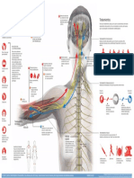 Infografico Fibromialgia