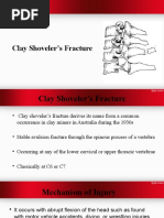 Clay Shoveler's Fracture