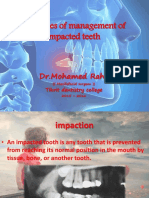 Management of Impacted Teeth