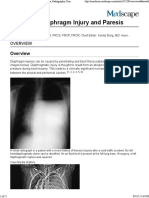 Imaging in Diaphragma