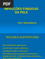 5 - Infecções Fúngicas Da Pele