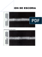 Calificación de Radiografias