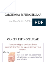 Carcinoma Espinocelular