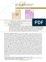 Basal Cell Carcinoma