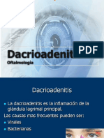 Dacrioadenitis