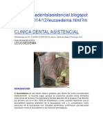 Patologia Leucoedema