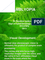 Mata - Amblyopia