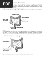 (Medicine) Surgical Removal of A Portion of The Colon.: Hemicolectomy-P1. Anastomoses