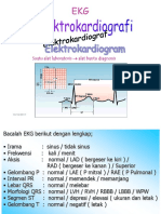 EKG Banget