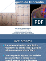 01 - Infarto Agudo Do Miocardio