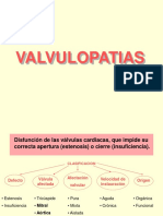 VALVULOPATIAS