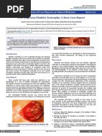 True Duplicate Bladder Exstrophy: A Rare Case Report: Archives of Case Reports in Clinical Medicine