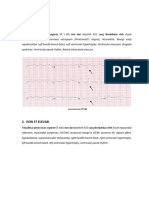 EKG Abnormal