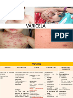 Varicela Herpes