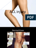 Anteriorcruciateligamentinjury 090619120341 Phpapp01 121206081353 Phpapp02