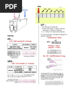 A Simplified ECG Guide