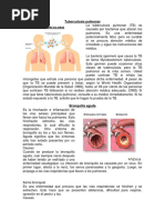 Tuberculosis Pulmonar