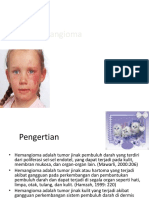 Hemangioma